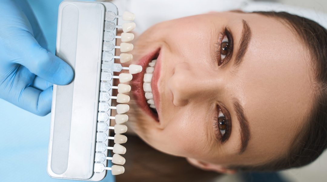 Happy young lady is visiting dental clinic for taking care of teeth and getting better smile