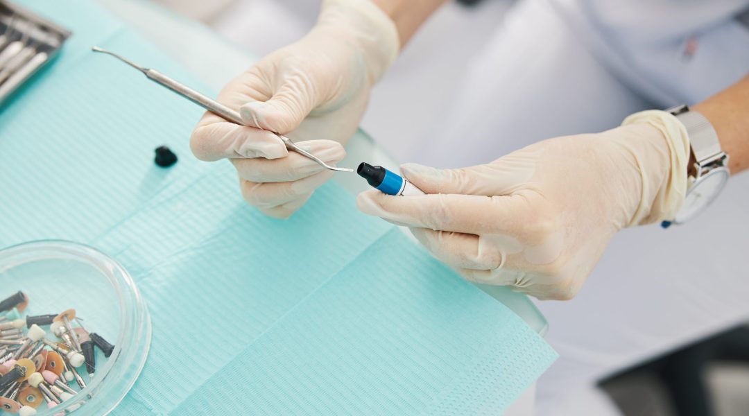 Worker of dental clinic tilting little vial with composite resin material over the tip of steel plugger